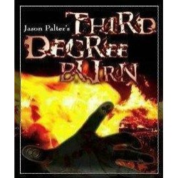 Jason Palter - Third Degree Burn